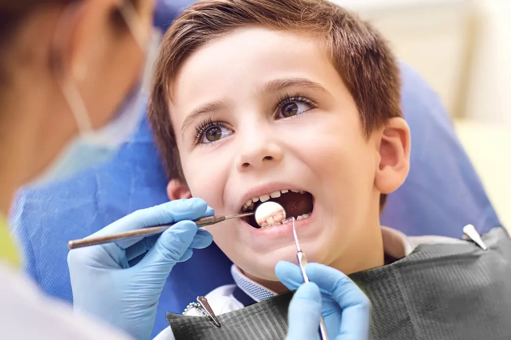 Tooth-Colored Fillings